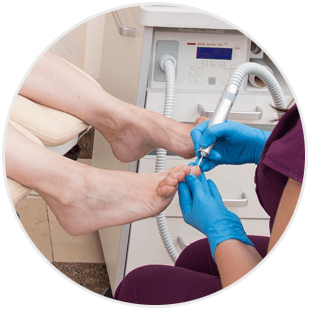 Pedicure leczniczy