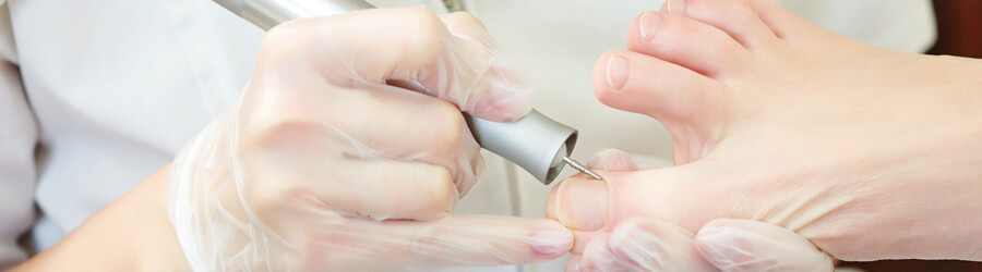 Pedicure leczniczy